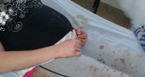 Com ciúmes, homem espanca ex por ela engravidar do atual namorado