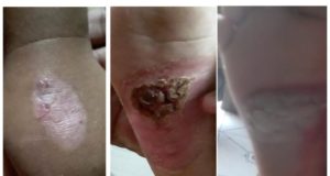 Pai é preso suspeito de queimar corpo e torturar filha de três anos, em Manaus