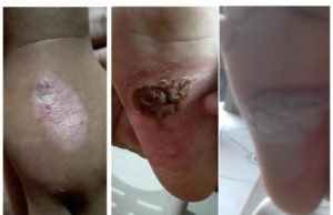 Pai é preso suspeito de queimar corpo e torturar filha de três anos, em Manaus