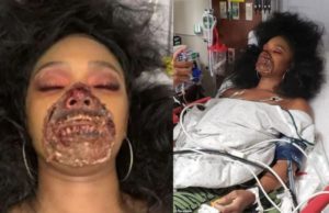 Dançarina passa mal após maquiagem zumbi e deixa médicos em pânico