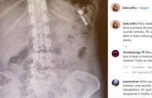Chef de cozinha engole fone de ouvido: ”Estava no bolso com vitaminas”