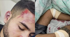 Jovem é espancado brutalmente em bloco de carnaval após tentar proteger prima de assédio