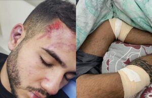 Jovem é espancado brutalmente em bloco de carnaval após tentar proteger prima de assédio
