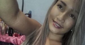 Parintinense com tumor na cabeça pede socorro no Face
