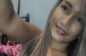 Parintinense com tumor na cabeça pede socorro no Face