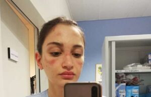 Enfermeria compartilha sofrimento sobre trabalho em meio ao Coronavírus na Itália