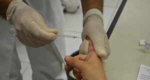 FVS-AM alerta população para identificar tuberculose durante a pandemia de Covid-19