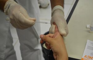 FVS-AM alerta população para identificar tuberculose durante a pandemia de Covid-19