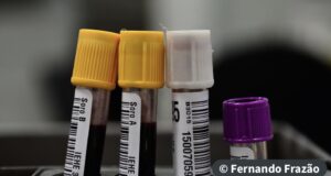 Hemorio inicia testes com plasma sanguíneo no tratamento de covid-19