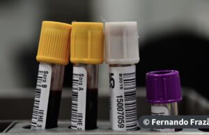 Hemorio inicia testes com plasma sanguíneo no tratamento de covid-19