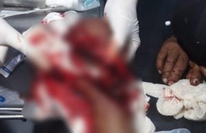 Homem decepa mão de vizinho com terçado em Benjamim ConstantO suspeito foi conduzido para o 51º Distrito Integrado de Polícia