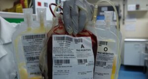 Amazonas utilizará plasma sanguíneo no tratamento de Covid-19