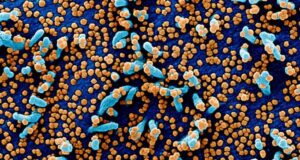 Novo tratamento para coronavírus é testado em tecido humano
