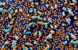 Novo tratamento para coronavírus é testado em tecido humano