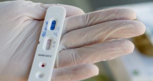 Anvisa aprova testes rápidos para covid-19 em farmáciasMedida visa diminuir aglomeração de pessoas em hospitais