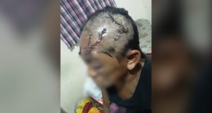 Por não aceitar fim de relacionamento, homem tentar matar ex-sogra brutalmenteA ex-companheira também foi agredida; vizinhos socorreram as duas