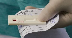 Vital Brazil e UFRJ testam soro para tratar covid-19Medicamento é do mesmo tipo dos usados contra a raiva