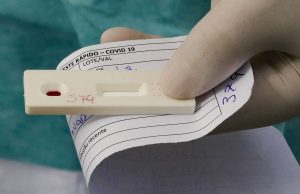 Vital Brazil e UFRJ testam soro para tratar covid-19Medicamento é do mesmo tipo dos usados contra a raiva