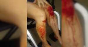Jovem pula de carro para não ser estuprada: “Pior dia da minha vida”Suspeito, que é motorista de app, se passou por loteiro no Paranoá para fazer a vítima entrar no veículo. Ele foi preso em flagrante