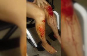 Jovem pula de carro para não ser estuprada: “Pior dia da minha vida”Suspeito, que é motorista de app, se passou por loteiro no Paranoá para fazer a vítima entrar no veículo. Ele foi preso em flagrante