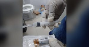 Funcionária é encontrada morta em banheiro de hospital da SamelA causa da morte ainda está sob investigação