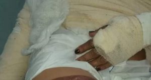 Doméstica é incendiada pelo marido enquanto dormia em ManacapuruCrime bárbaro