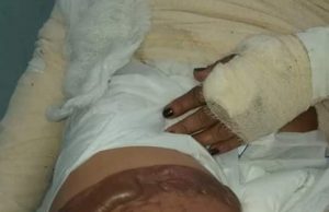 Doméstica é incendiada pelo marido enquanto dormia em ManacapuruCrime bárbaro