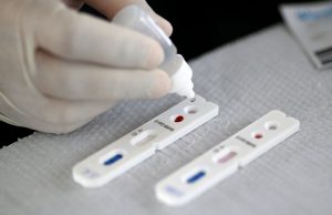 Pesquisadores desenvolvem testes rápidos para detectar coronavírusMeta é buscar metodologia de baixo custo para diagnóstico da covid-19