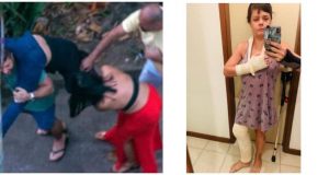 Médica é espancada por frequentadores do ‘Baile do Covid-19’Após reclamar do som e danificar o carro de um PM que estava em uma "Festa do corona", anestesista tem joelho quebrado e mãos pisoteadas por cinco homens