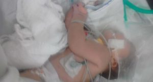 Em Iranduba, bebê jogada no mato pela mãe foi toda picada por insetosCrueldade e perigo