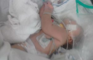 Em Iranduba, bebê jogada no mato pela mãe foi toda picada por insetosCrueldade e perigo