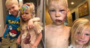 Herói: menino de 6 anos salva vida da irmã de ataque de cachorro“Se alguém tivesse que morrer, pensei que deveria ser eu”, disse a criança