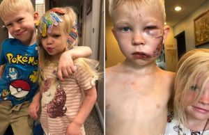 Herói: menino de 6 anos salva vida da irmã de ataque de cachorro“Se alguém tivesse que morrer, pensei que deveria ser eu”, disse a criança