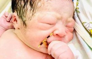 Bebê nasce segurando DIU que mãe implantou para evitar gravidezEsse aí ninguém segura