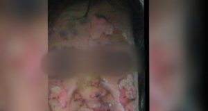 Em Manaus, adolescente joga perfume no rosto da irmã de 5 anos e ateia fogo"As meninas são filhas de pais diferentes e adolescente sempre deixou bem claro que nunca gostou da menor", disse a irmã mais velha