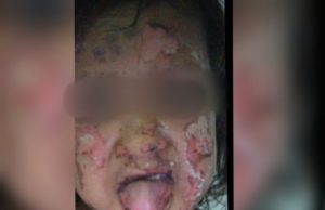 Em Manaus, adolescente joga perfume no rosto da irmã de 5 anos e ateia fogo"As meninas são filhas de pais diferentes e adolescente sempre deixou bem claro que nunca gostou da menor", disse a irmã mais velha