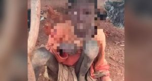 Menino acorrentado que sobrevivia comendo ração de animais é resgatado