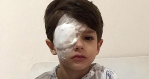 Mãe alerta famílias após filho queimar olho com álcool gelPerigo dentro de casa