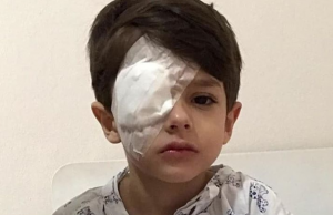 Mãe alerta famílias após filho queimar olho com álcool gelPerigo dentro de casa