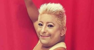 Patixa Teló completa 43 anos e precisa de ajuda, não de piadas!Parabéns!!