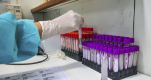 Nove em 10 pacientes curados da covid-19 apresentam efeitos colateriasFadiga, perda do olfato ou paladar e distúrbios psicológicos