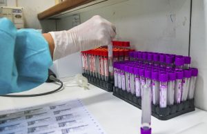 Nove em 10 pacientes curados da covid-19 apresentam efeitos colateriasFadiga, perda do olfato ou paladar e distúrbios psicológicos