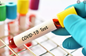 URGENTE: Amazonas registra 1.214 novos casos de Covid em apenas 24hNúmeros de sábado