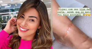 Vivian Amorim sofre acidente com linha de cerol em ManausPerigo