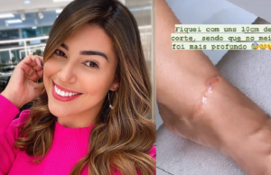 Vivian Amorim sofre acidente com linha de cerol em ManausPerigo