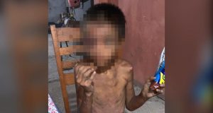 Criança é resgatada desnutrida, com cabeça raspada e ferimentos pelo corpo Crueldade