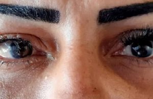 Mulher fica com visão comprometida após colocar cílios postiços em clínica de estéticaDe acordo com a vítima, a responsável pelo procedimento deixou cair a cola dentro dos seus olhos