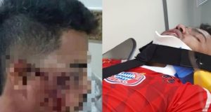 Jogador tem rosto quebrado por chutes do rival e da torcida no PeladãoDrama em Manaus