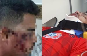 Jogador tem rosto quebrado por chutes do rival e da torcida no PeladãoDrama em Manaus
