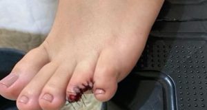 Jovem perde parte do dedo do pé após ataque de piranhas em praiaO fato aconteceu no município de Itaituba, no Pará